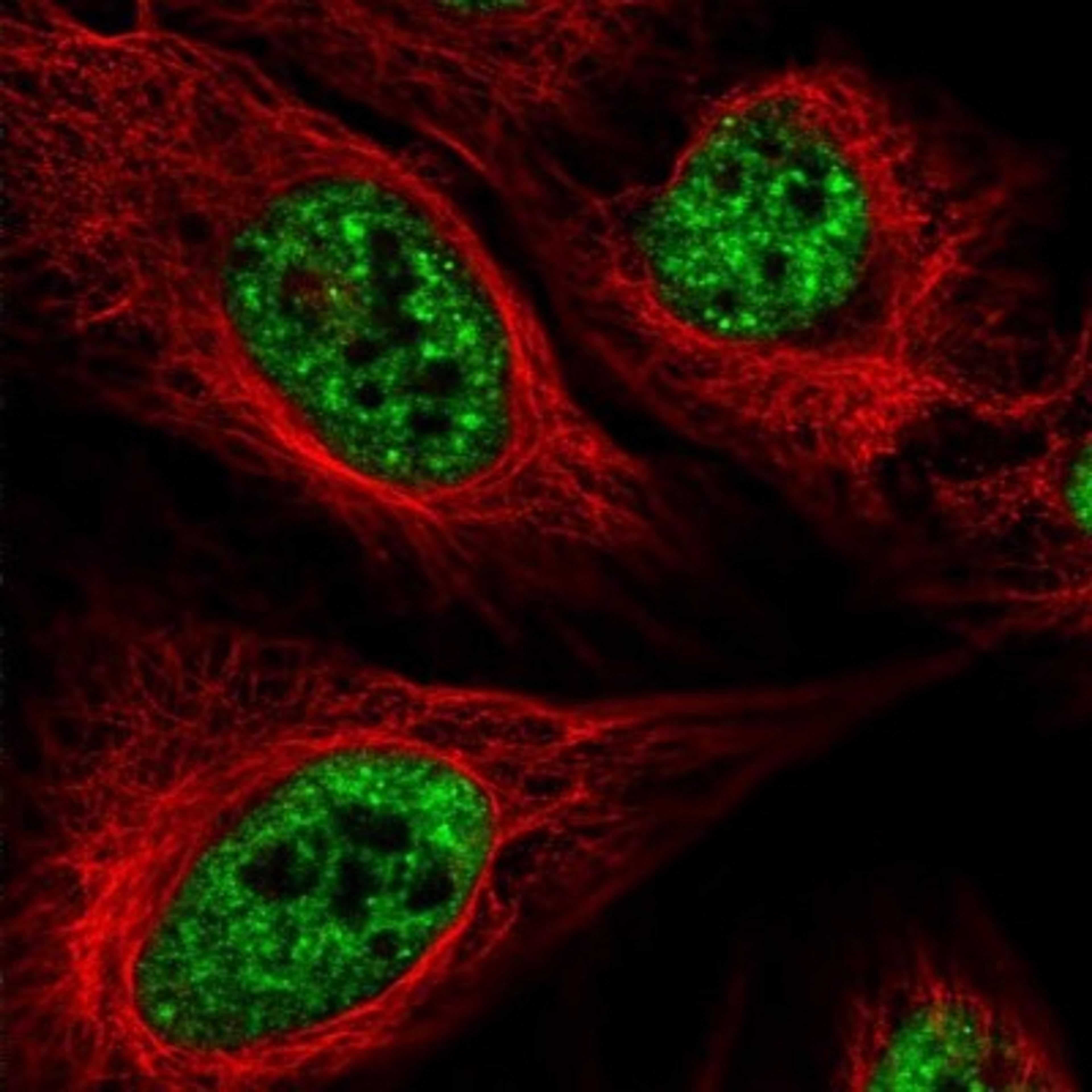 Immunocytochemistry/Immunofluorescence: SMTNL2 Antibody [NBP1-81904] - Staining of human cell line U-2 OS shows positivity in nucleus but not nucleoli.