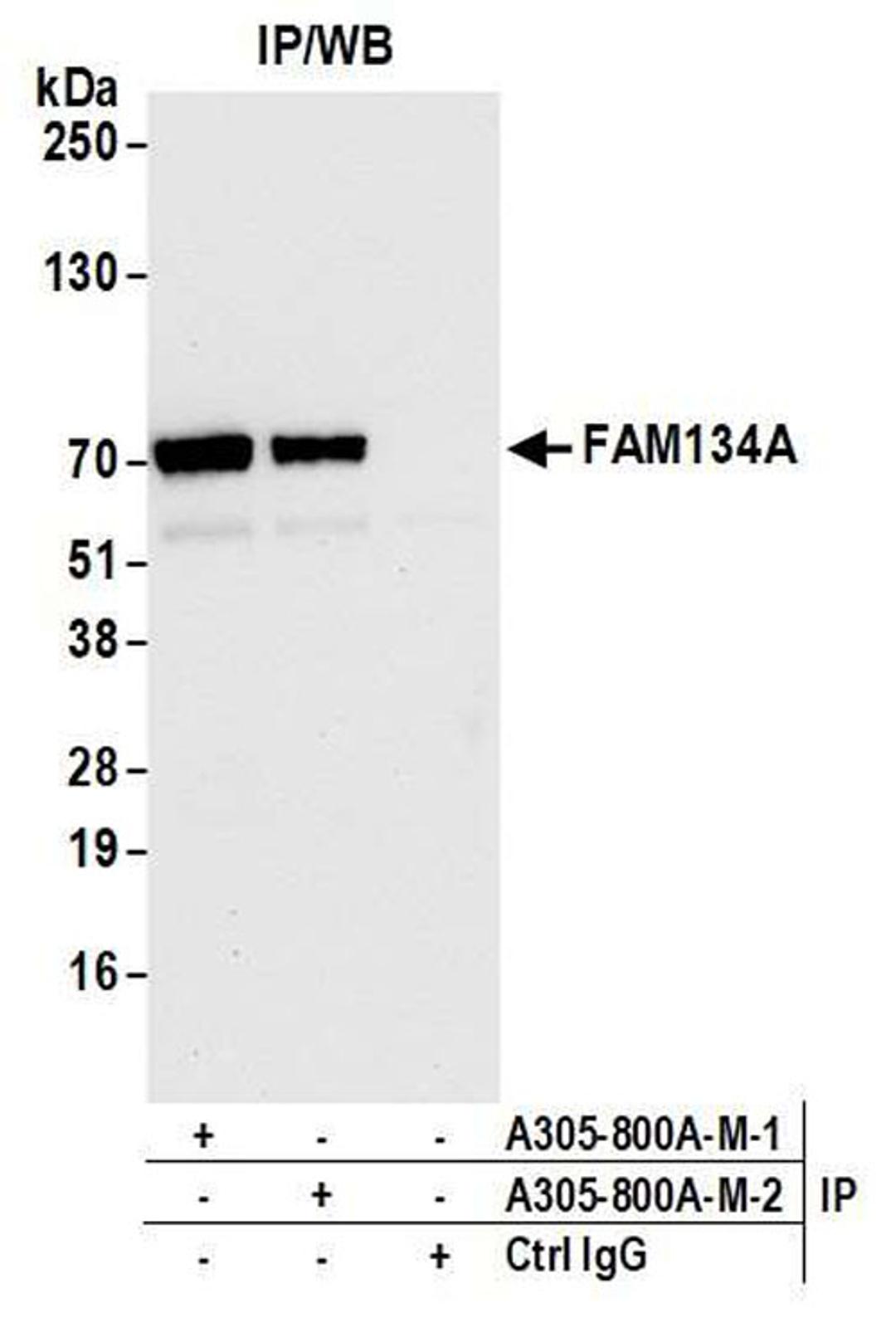 Detection of human FAM134A by WB of IP.