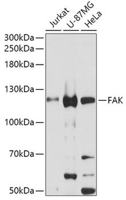 Western blot - PTK2 antibody (A11195)