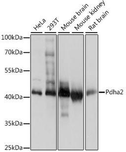 Western blot - Pdha2 antibody (A14994)