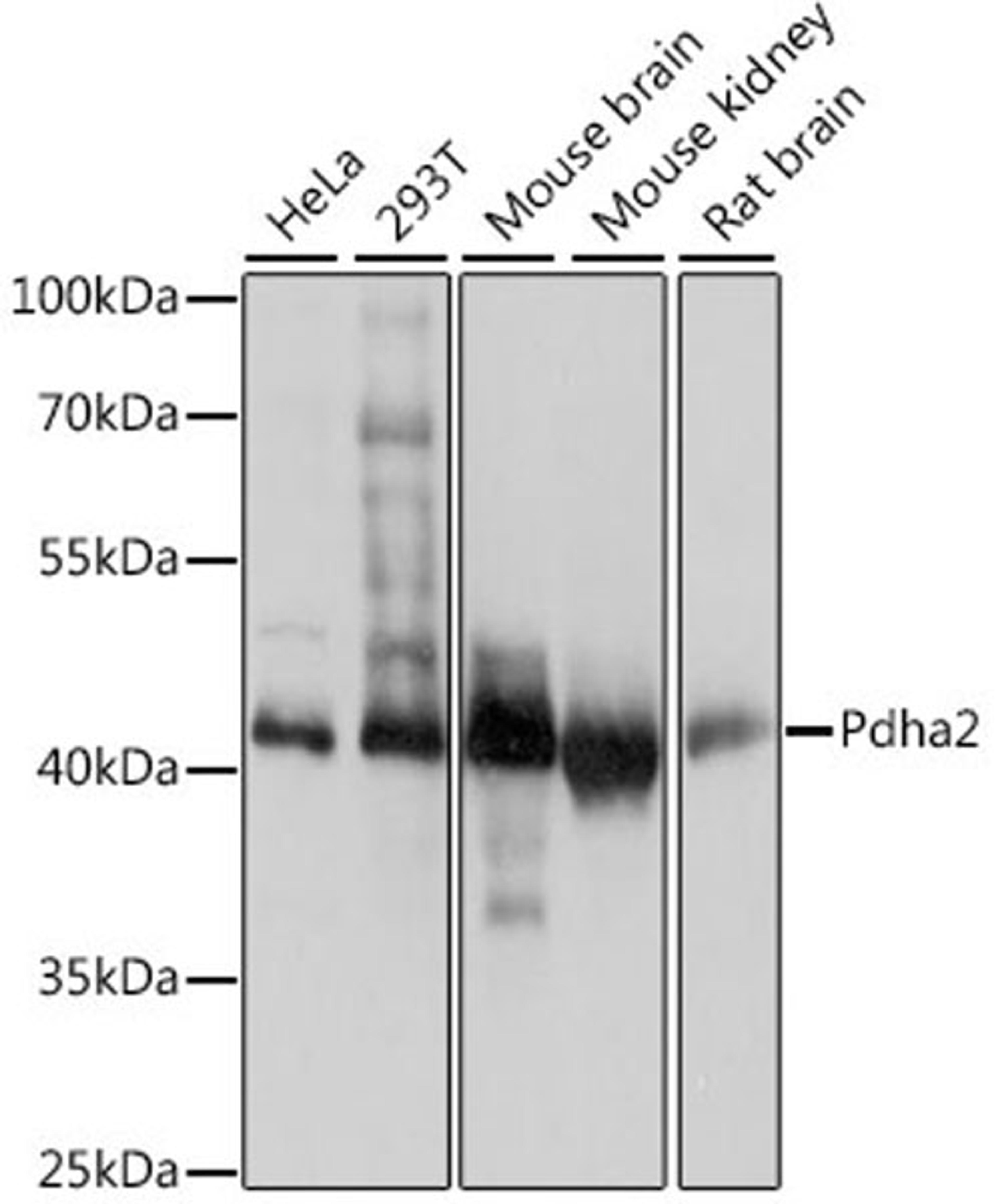 Western blot - Pdha2 antibody (A14994)