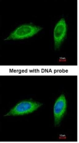 Immunocytochemistry/Immunofluorescence: MTHFD2 Antibody [NBP1-33200] - Paraformaldehyde-fixed HeLa, using antibody at 1:200 dilution.