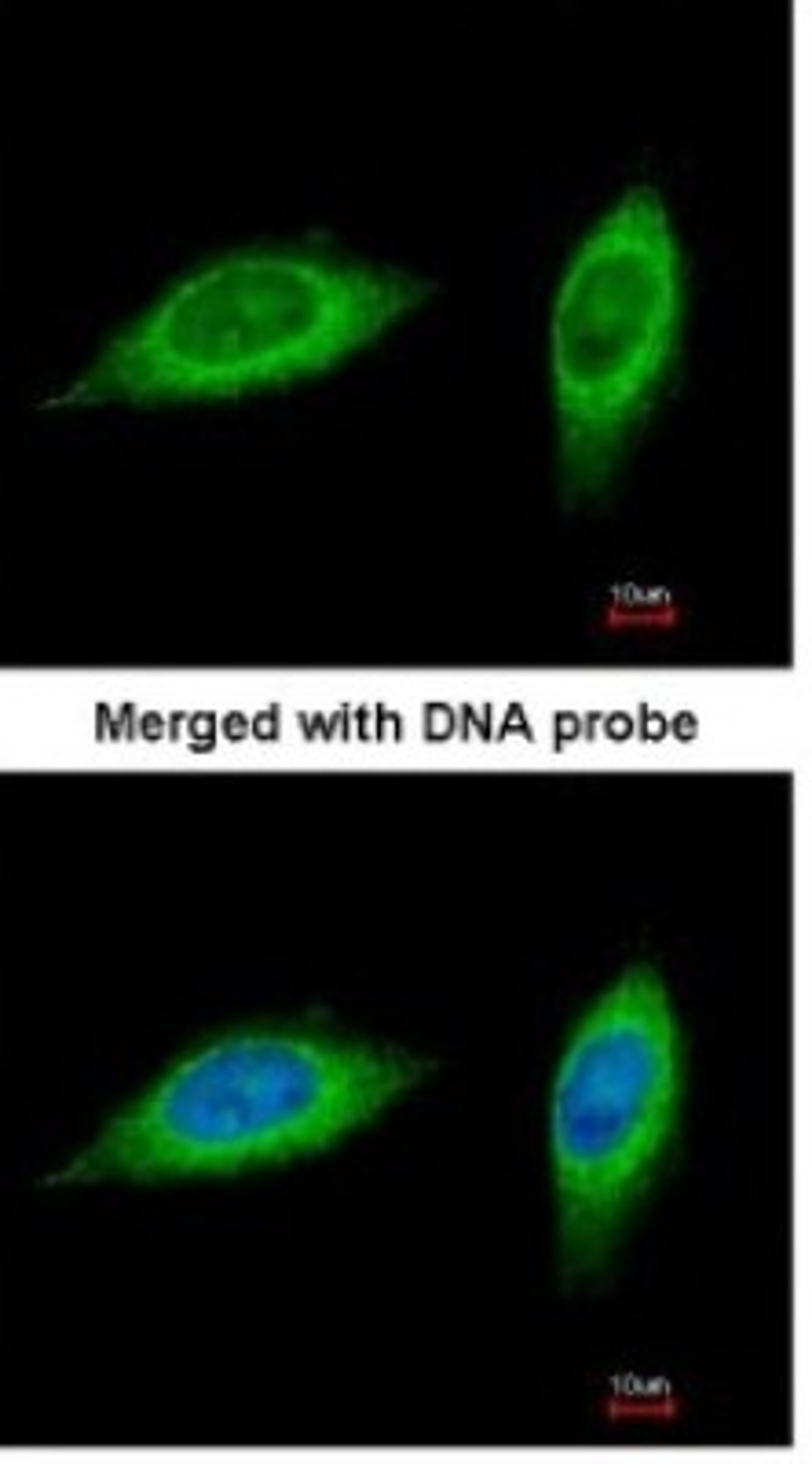 Immunocytochemistry/Immunofluorescence: MTHFD2 Antibody [NBP1-33200] - Paraformaldehyde-fixed HeLa, using antibody at 1:200 dilution.