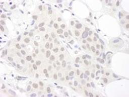 Detection of human Sm-D3 by immunohistochemistry.