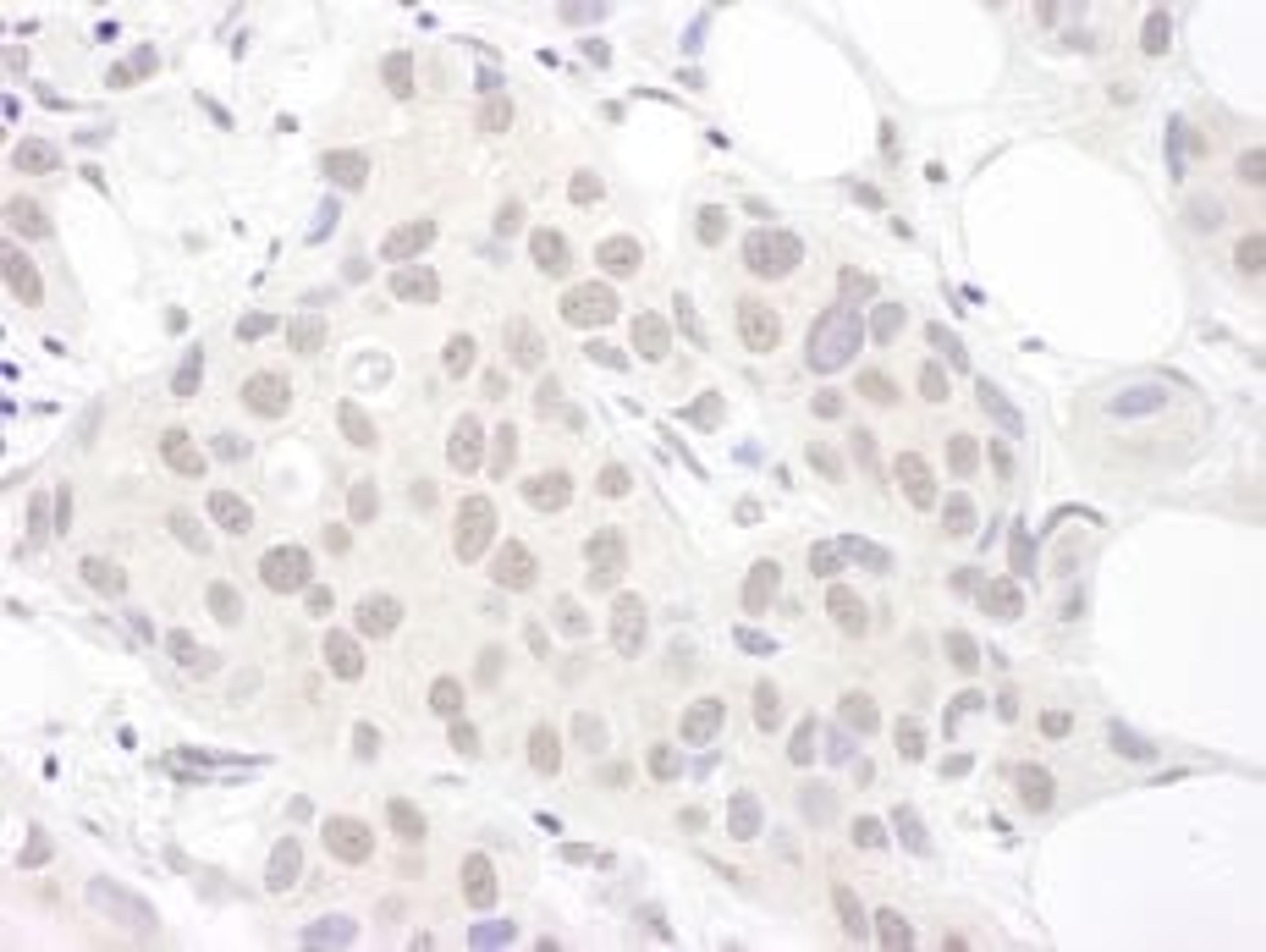 Detection of human Sm-D3 by immunohistochemistry.