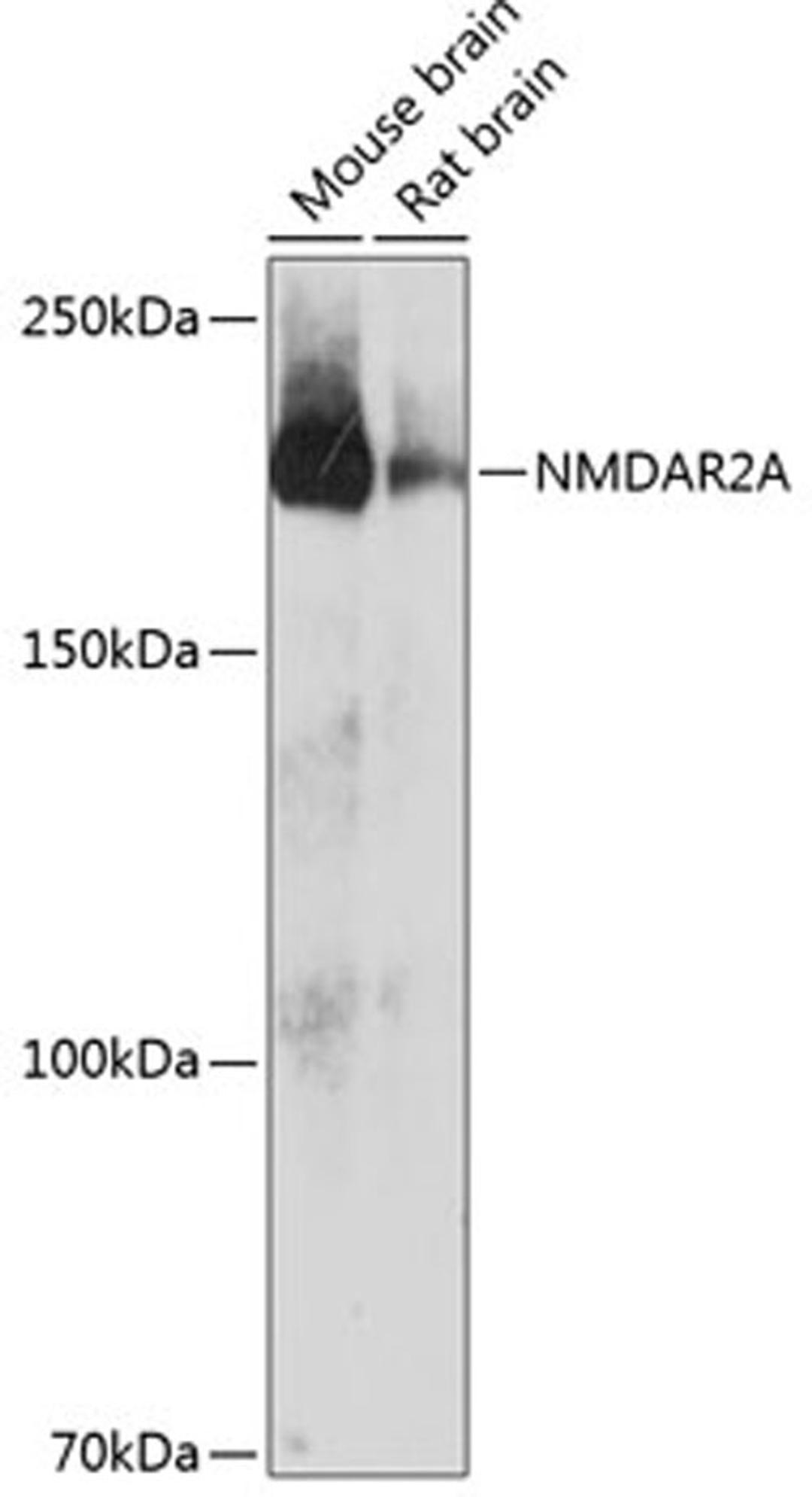 Western blot - NMDAR2A antibody (A19089)