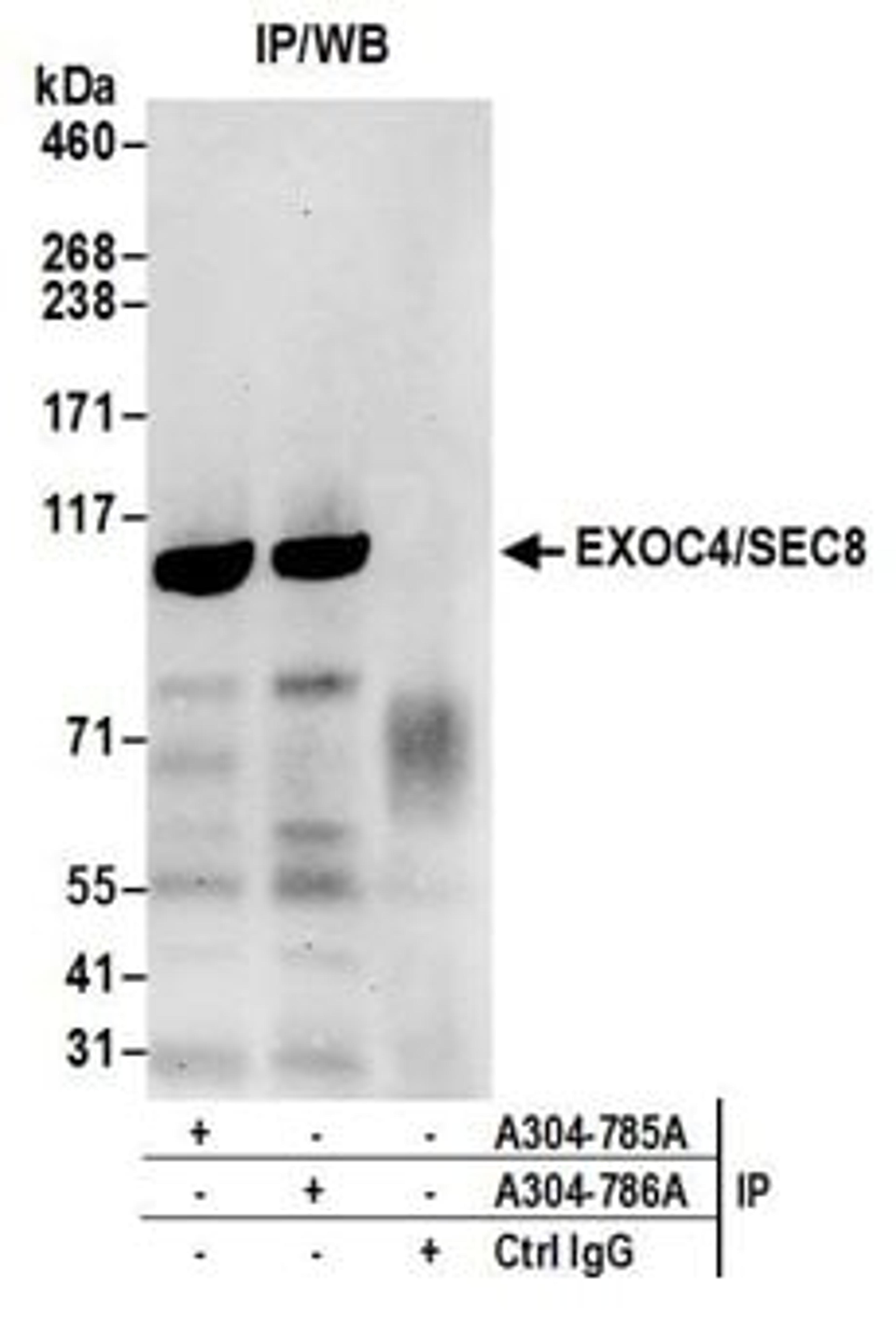 Detection of human EXOC4/SEC8 by western blot of immunoprecipitates.