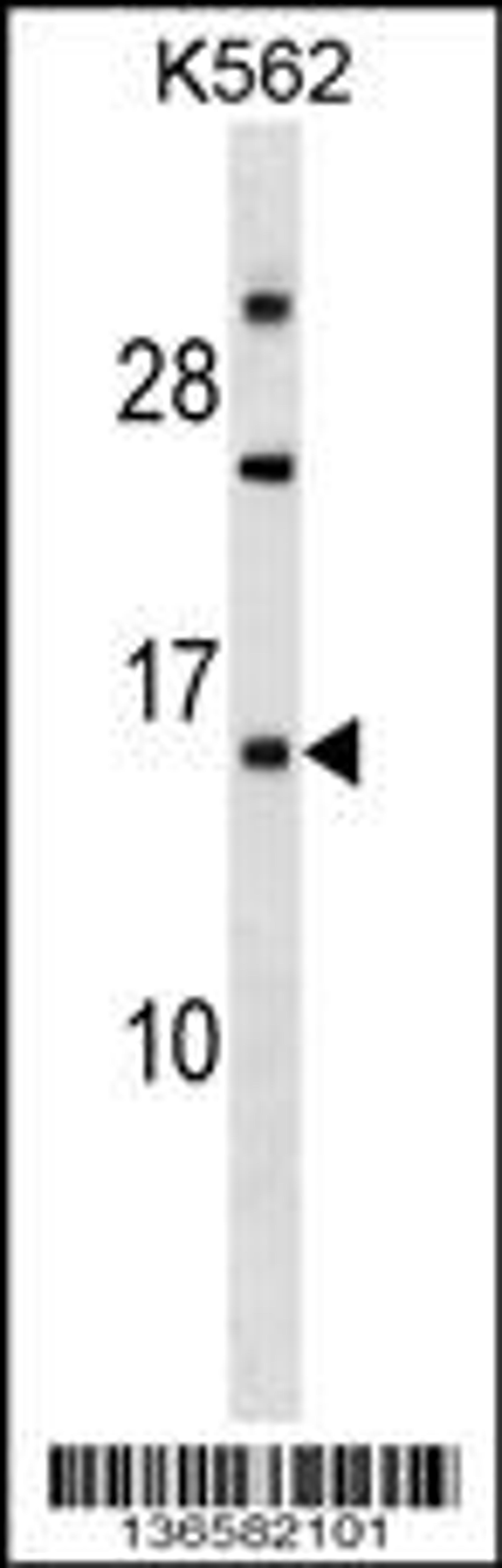 Western blot analysis in K562 cell line lysates (35ug/lane).