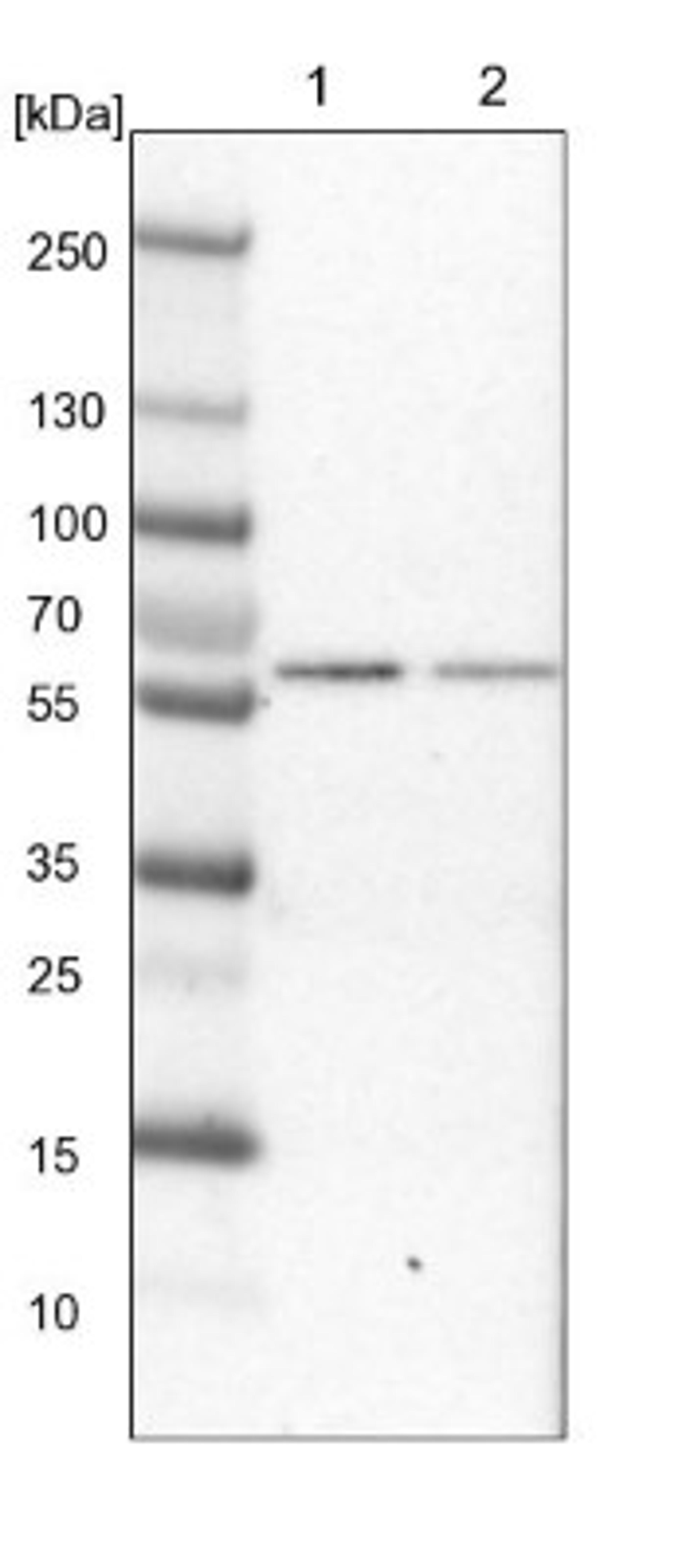 Western Blot: EFHA2 Antibody [NBP1-85152] - Lane 1: NIH-3T3 cell lysate (Mouse embryonic fibroblast cells)<br/>Lane 2: NBT-II cell lysate (Rat Wistar bladder tumour cells)