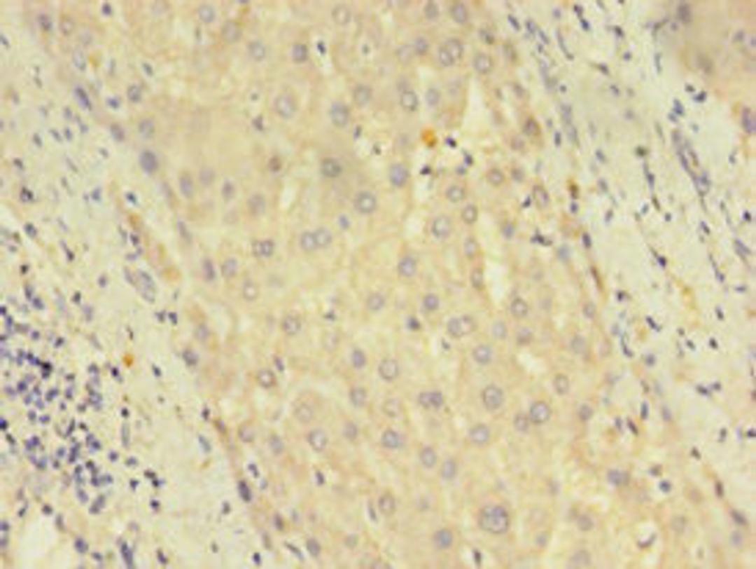 Immunohistochemistry of paraffin-embedded human liver tissue using CSB-PA863128LA01HU at dilution of 1:100