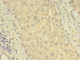 Immunohistochemistry of paraffin-embedded human liver tissue using CSB-PA863128LA01HU at dilution of 1:100