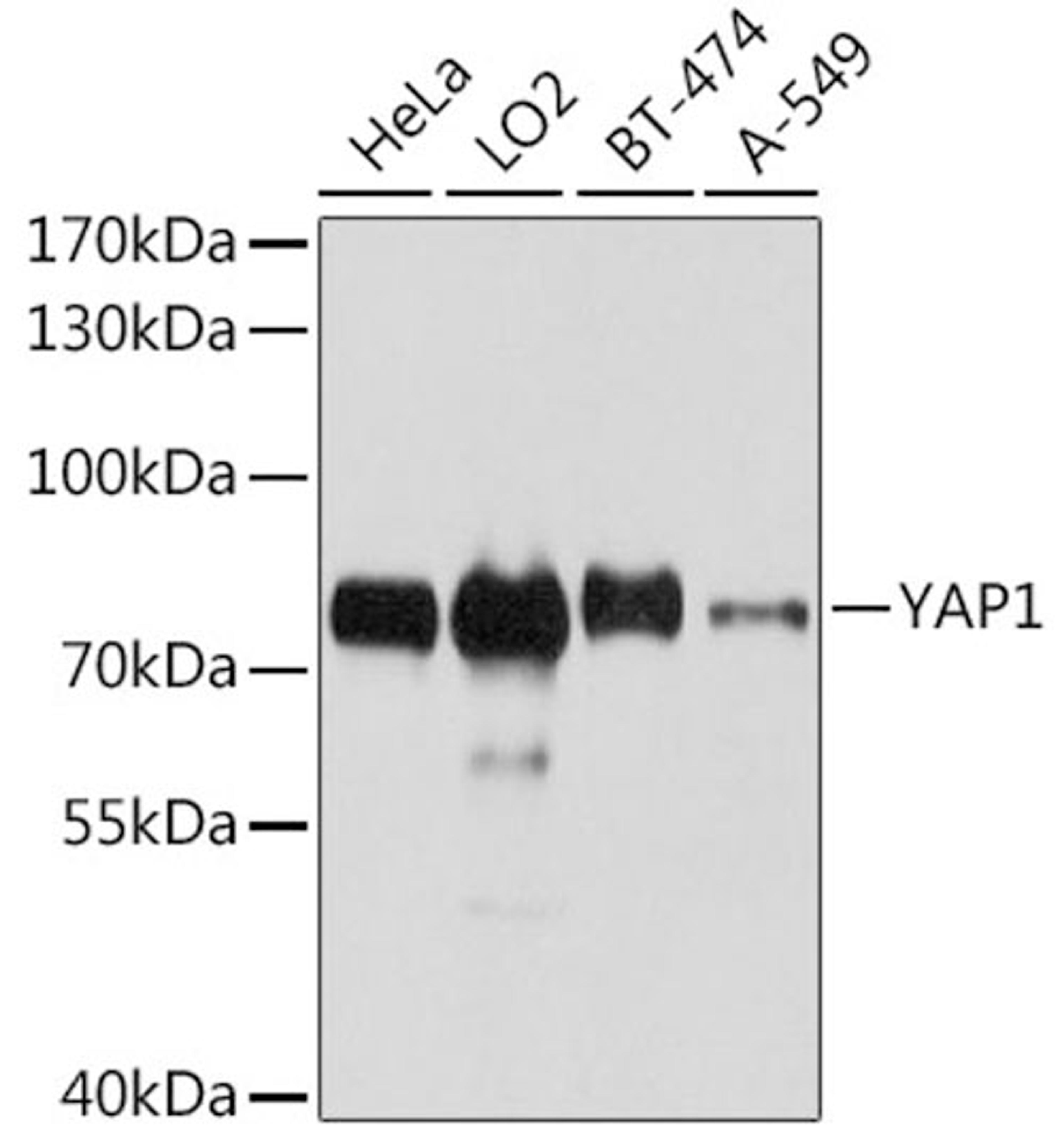 Western blot - YAP1 antibody (A1002)