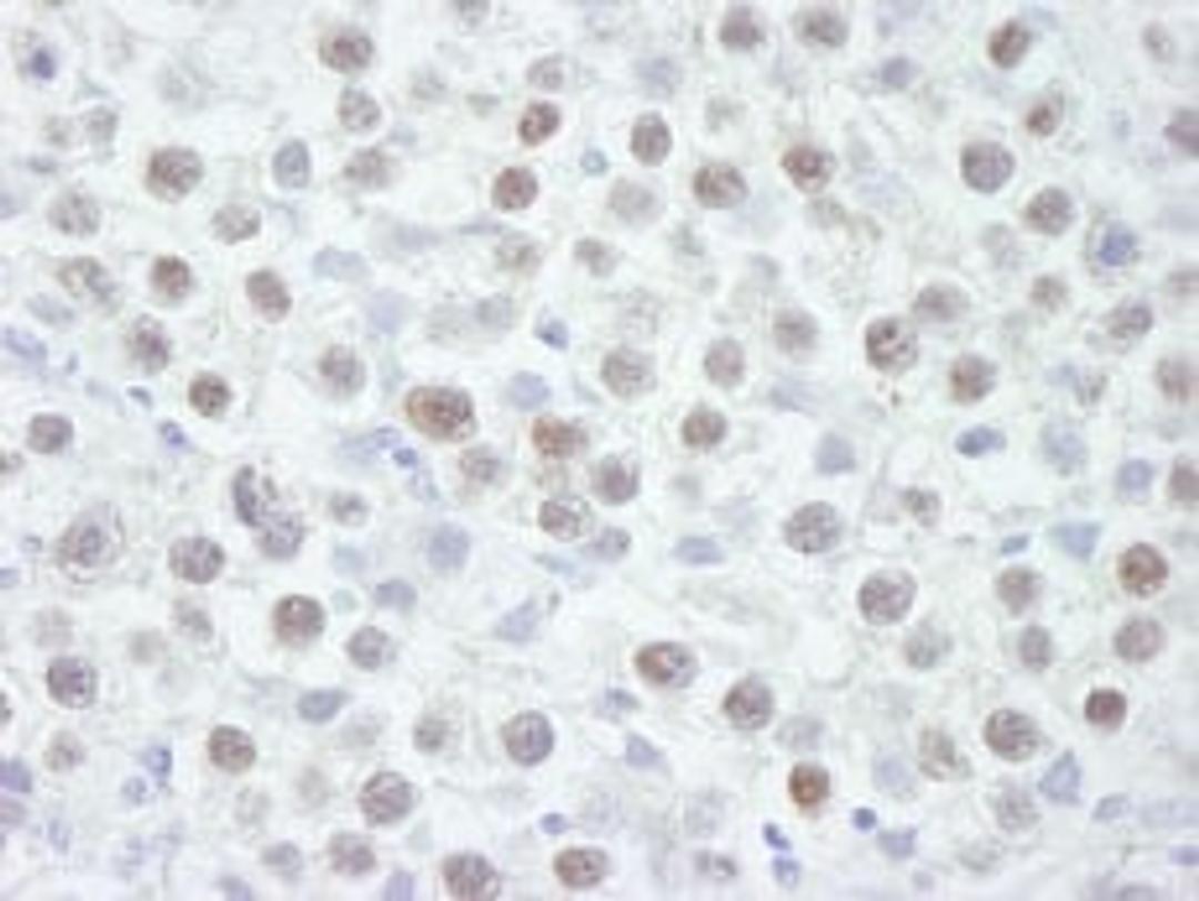 Detection of human CHK2 by immunohistochemistry.