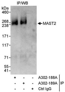 Detection of human MAST2 by western blot of immunoprecipitates.