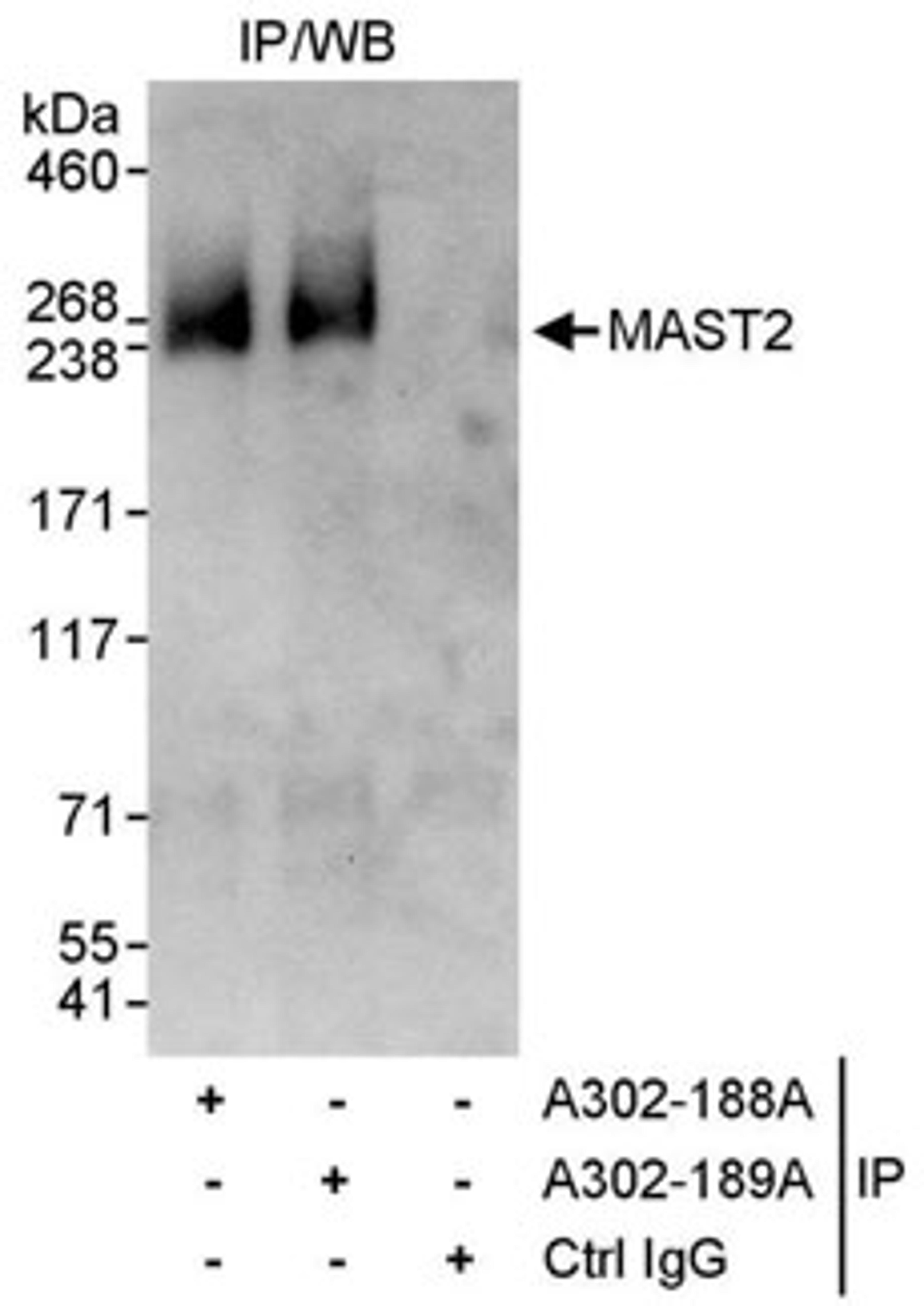 Detection of human MAST2 by western blot of immunoprecipitates.