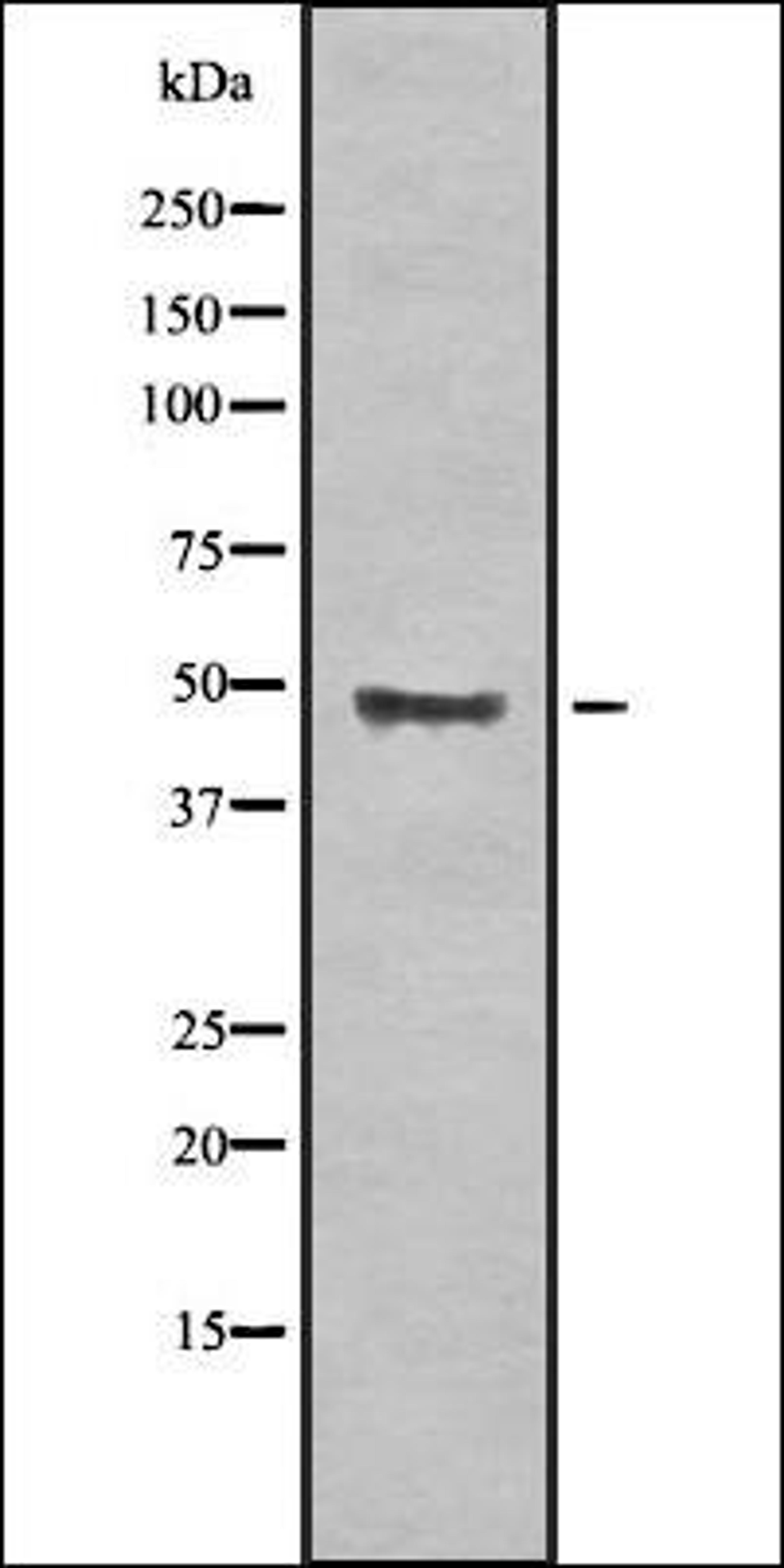 Western blot analysis of HEK293 cells using BECN1L1 antibody