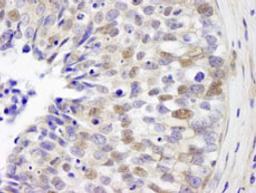 Detection of human IRF3 by immunohistochemistry.