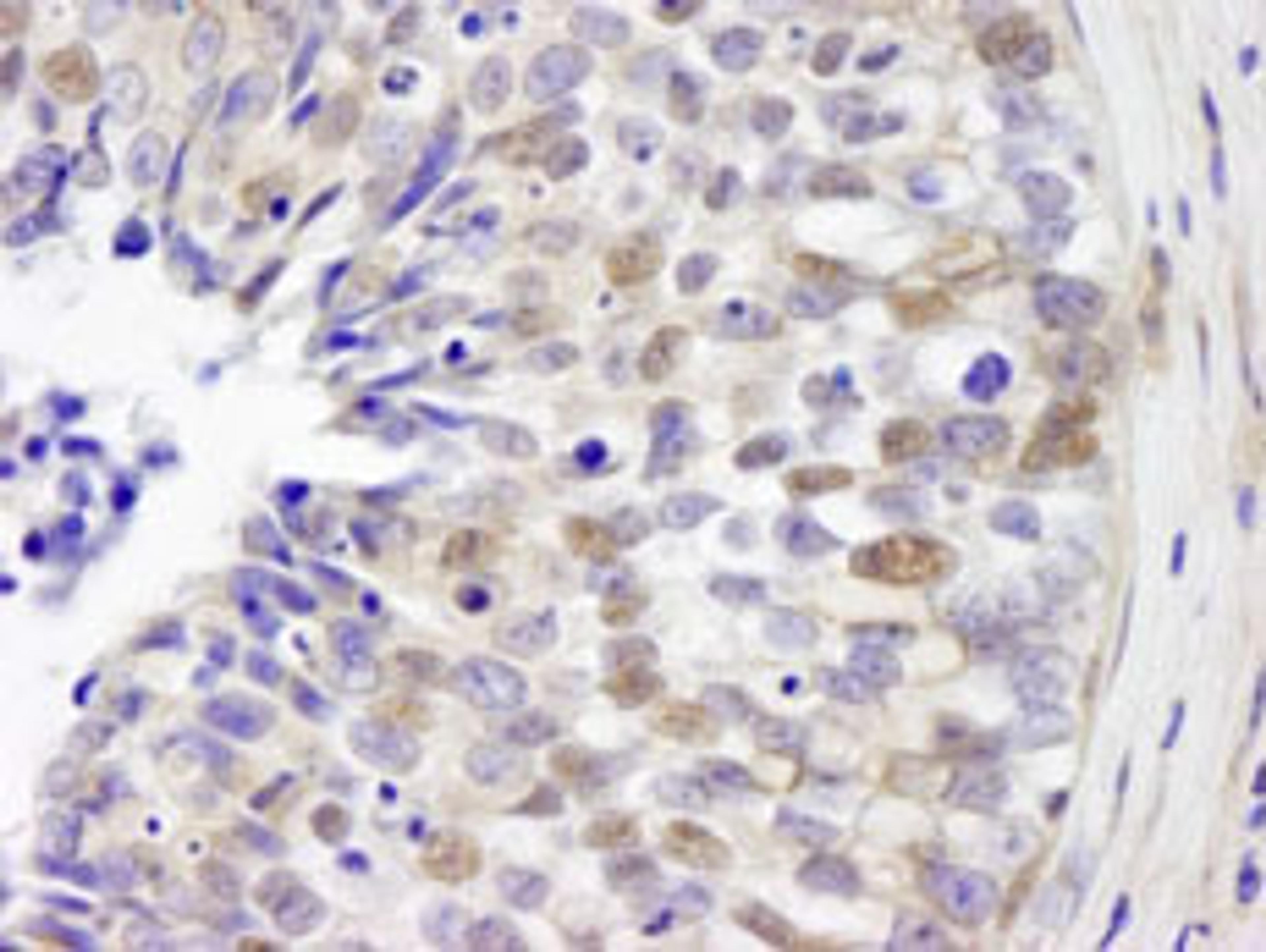 Detection of human IRF3 by immunohistochemistry.