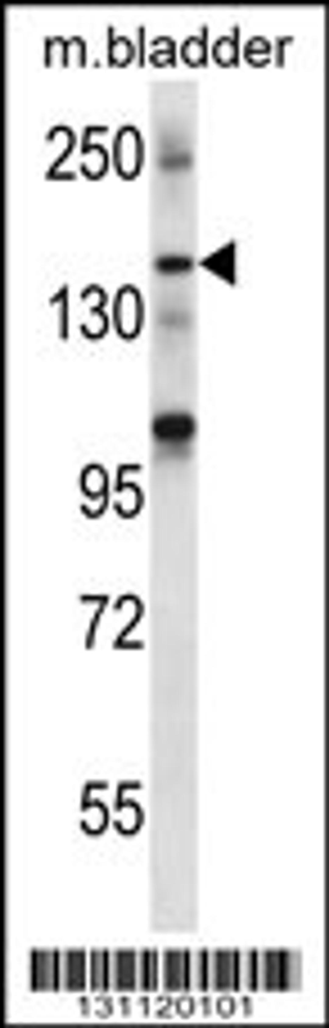 Western blot analysis in mouse bladder tissue lysates (35ug/lane).