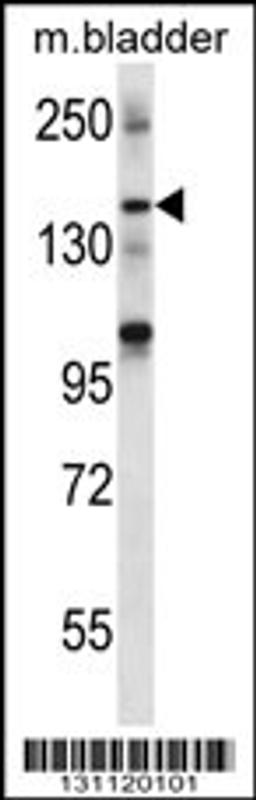 Western blot analysis in mouse bladder tissue lysates (35ug/lane).