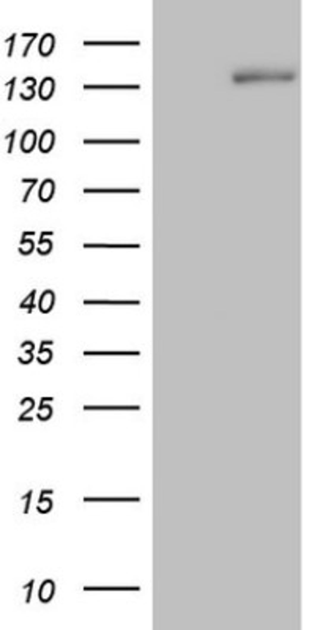 Western Blot: Hairless Antibody (1D9) [NBP2-46004] - Analysis of HEK293T cells were transfected with the pCMV6-ENTRY control (Left lane) or pCMV6-ENTRY Hairless.