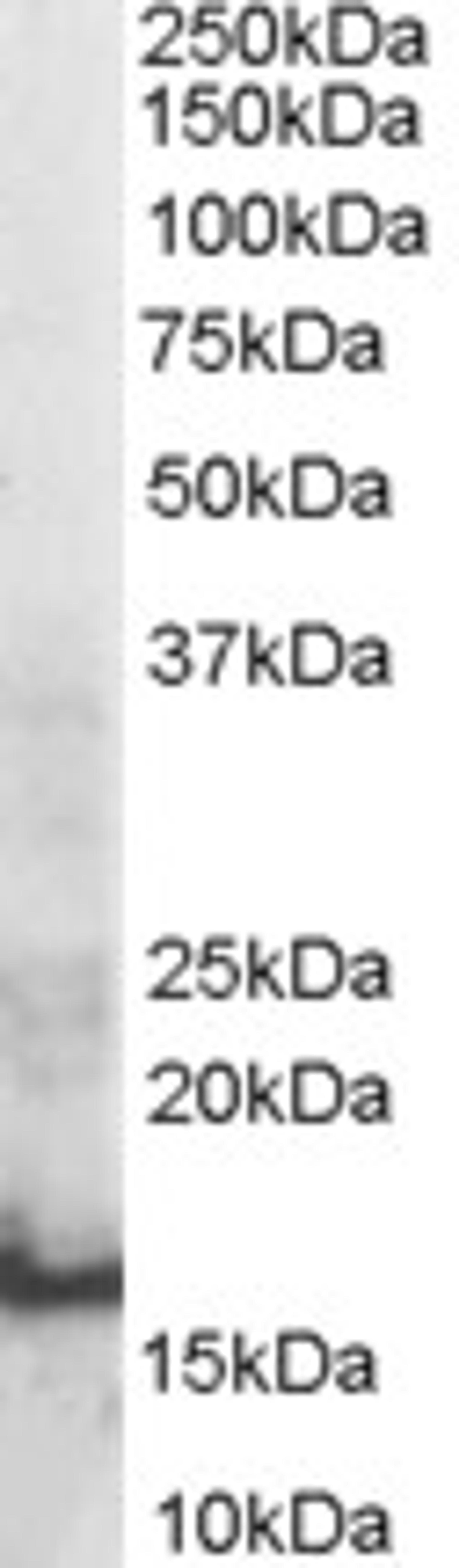 46-365 staining (0.3ug/ml) of Human Thymus lysate (RIPA buffer, 30ug total protein per lane). Primary incubated for 1 hour. Detected by western blot using chemiluminescence.