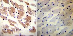 Immunohistochemistry-Paraffin: Ryanodine Receptor 1 Antibody (34C) [NB300-543] - Biopsies of deparaffinized Human skeletal muscle tissue.