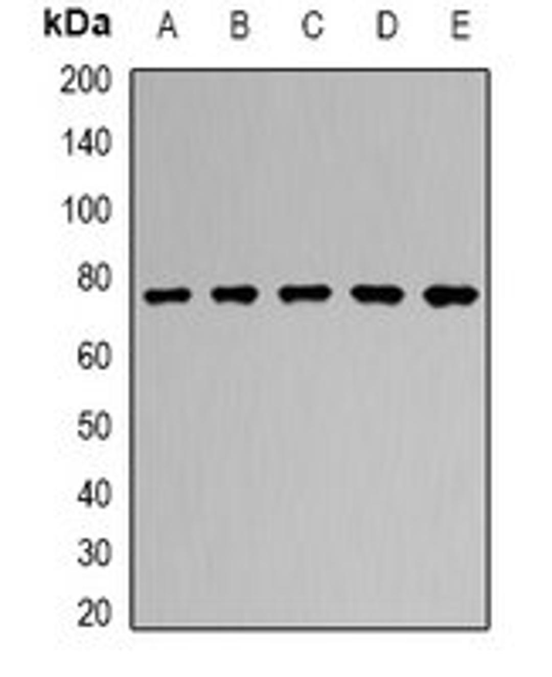 Western blot analysis of SKOV3 (Lane1), HepG2 (Lane2), mouse spleen (Lane3), mouse lung (Lane4), rat brain (Lane5) whole cell lysates using RUFY2 antibody