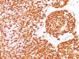 IHC test of FFPE human tonsil probed with CD45 antibody (clone PTPRC/1460). Required HIER: boil tissue sections in 10mM citrate buffer, pH 6, for 10-20 min.