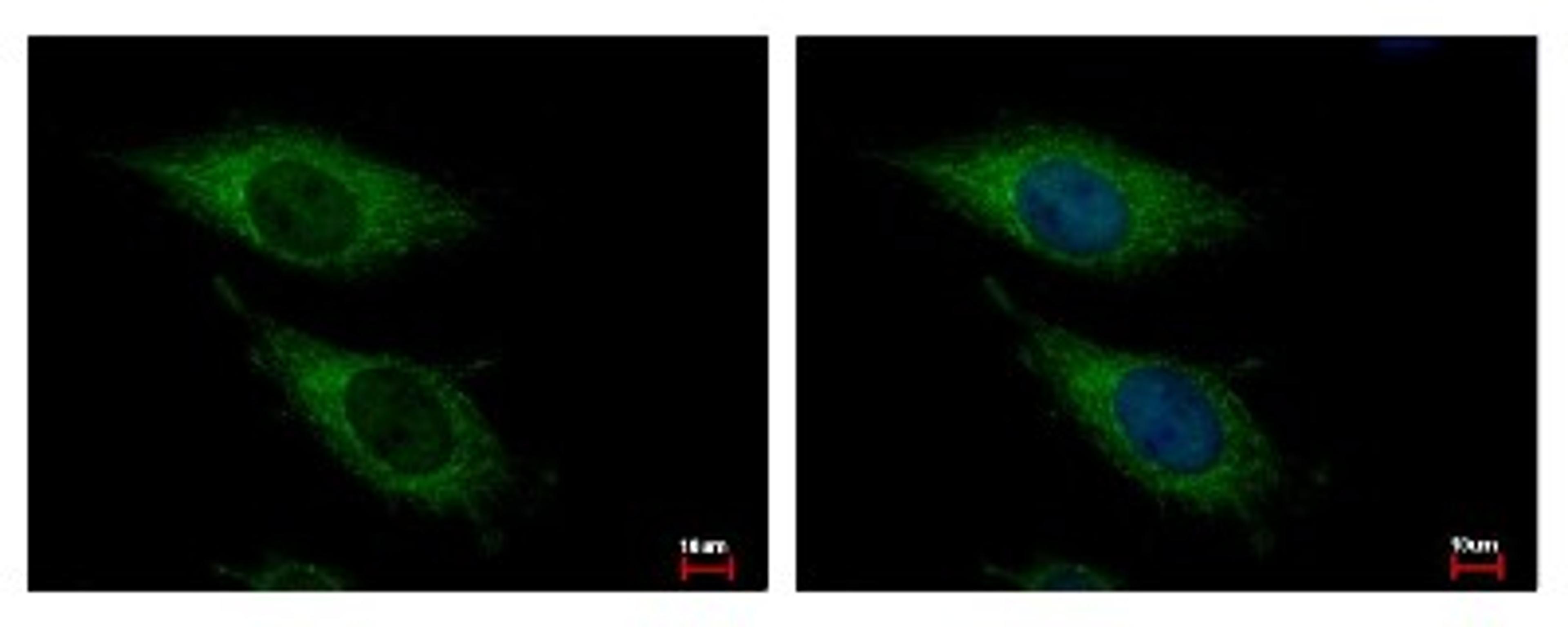 Immunocytochemistry/Immunofluorescence: OGDH Antibody [NBP2-19622] - Sample: HeLa cells were fixed in -20C 100% MeOH for 5 min. Green: OGDH protein stained by OGDH antibody, C-term diluted at 1:500. Blue: Hoechst 33343 staining.