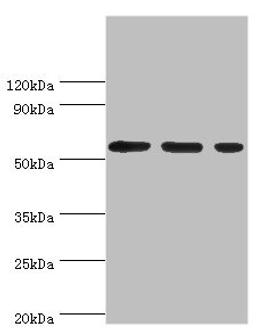 Western blot. All lanes: Aladin antibody at 5ug/ml. Lane 1: Hela whole cell lysate. Lane 2: Mouse brain tissue. Lane 3: NIH/3T3 whole cell lysate. Secondary. Goat polyclonal to rabbit IgG at 1/10000 dilution. Predicted band size: 60, 56 kDa. Observed band size: 60 kDa.