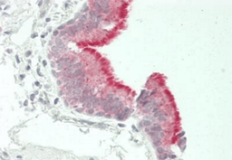 Immunohistochemical staining of Human Lung using DSG4 antibody