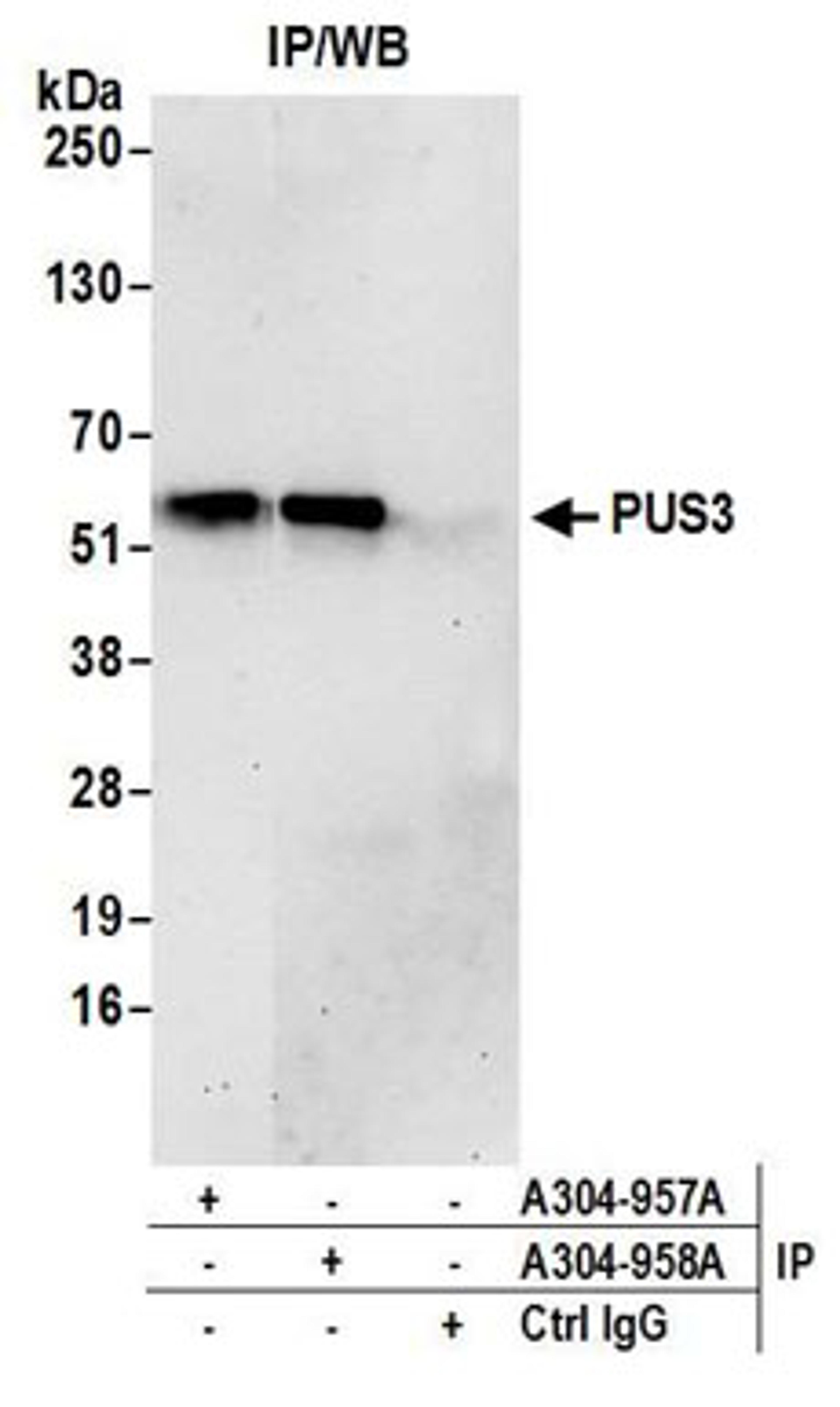 Detection of human PUS3 by western blot of immunoprecipitates.