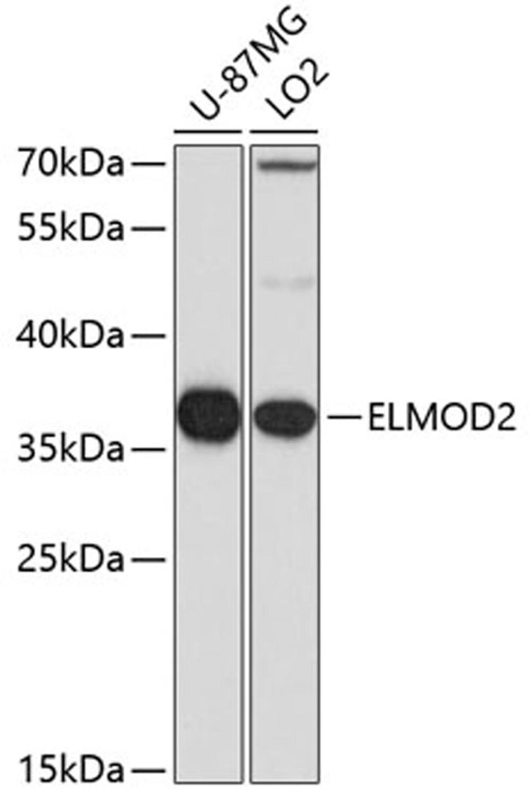 Western blot - ELMOD2 antibody (A7859)