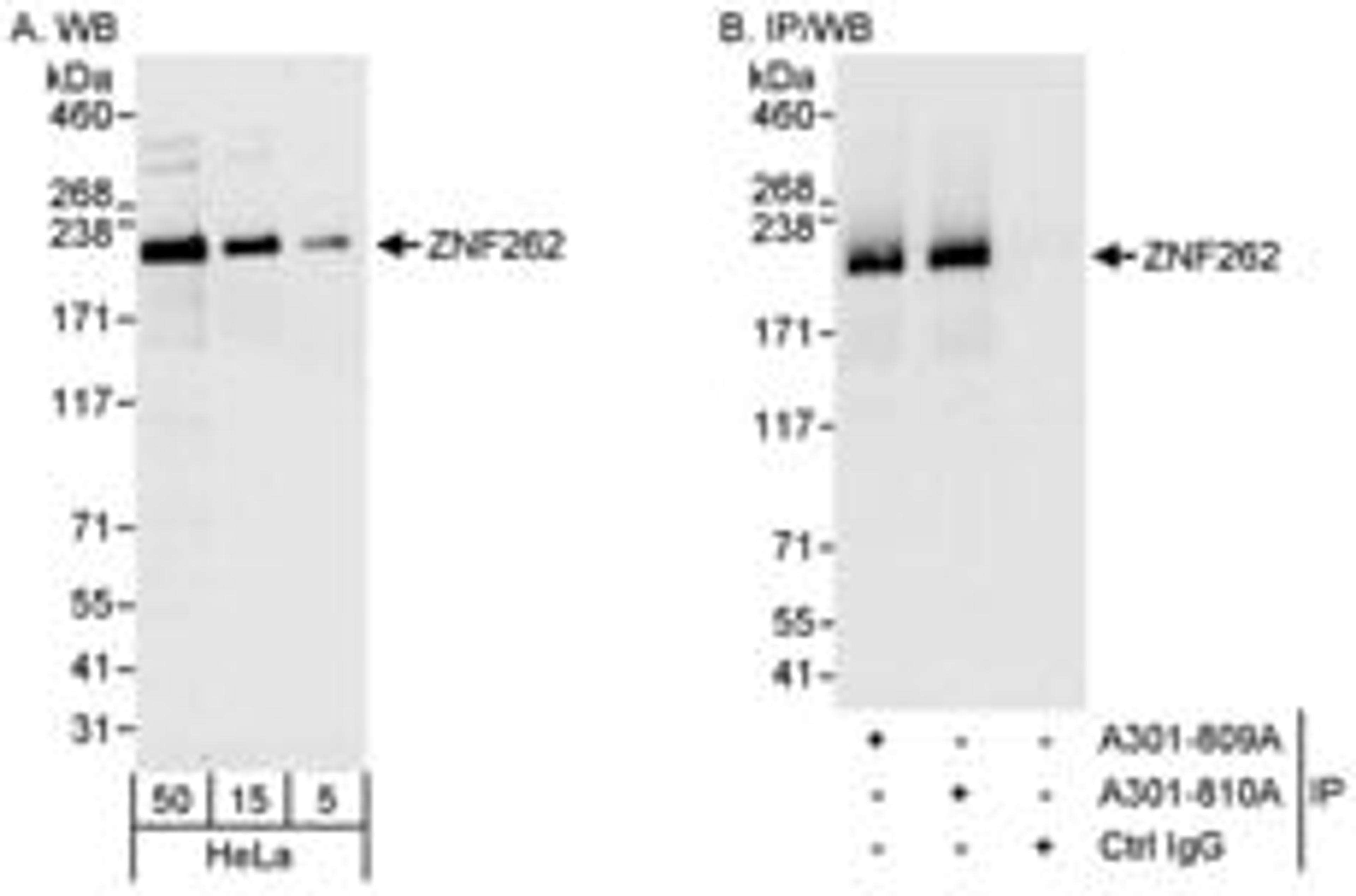 Detection of human ZNF262 by western blot and immunoprecipitation.