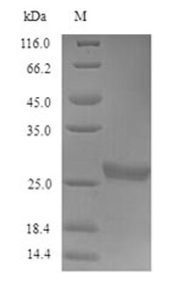(Tris-Glycine gel) Discontinuous SDS-PAGE (reduced) with 5% enrichment gel and 15% separation gel.