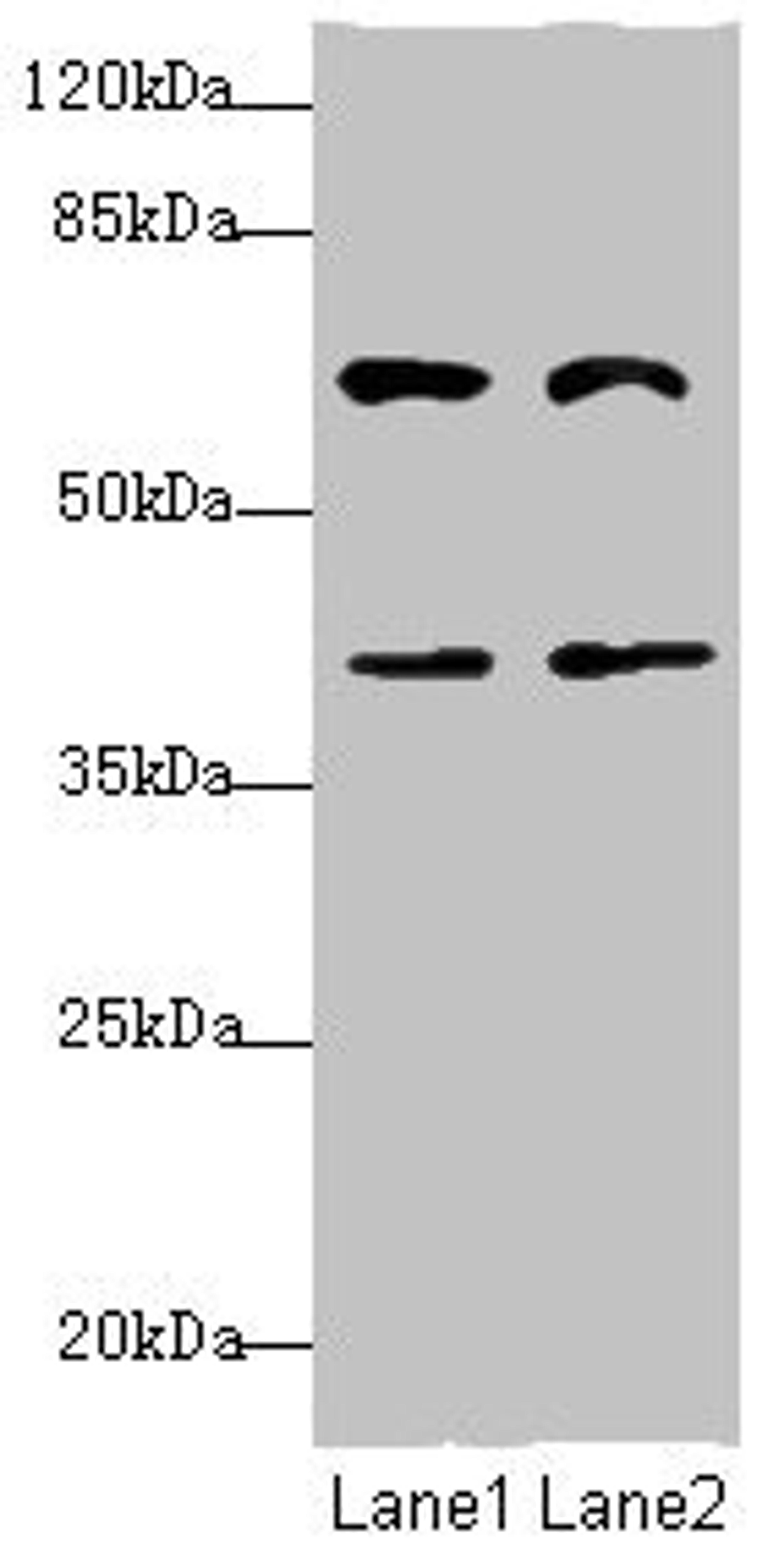 Western blot. All lanes: DCP1A antibody at 3.79ug/ml. Lane 1: Jurkat whole cell lysate. Lane 2: HepG2 whole cell lysate. Secondary. Goat polyclonal to rabbit IgG at 1/10000 dilution. Predicted band size: 64, 60 kDa. Observed band size: 64, 40 kDa.