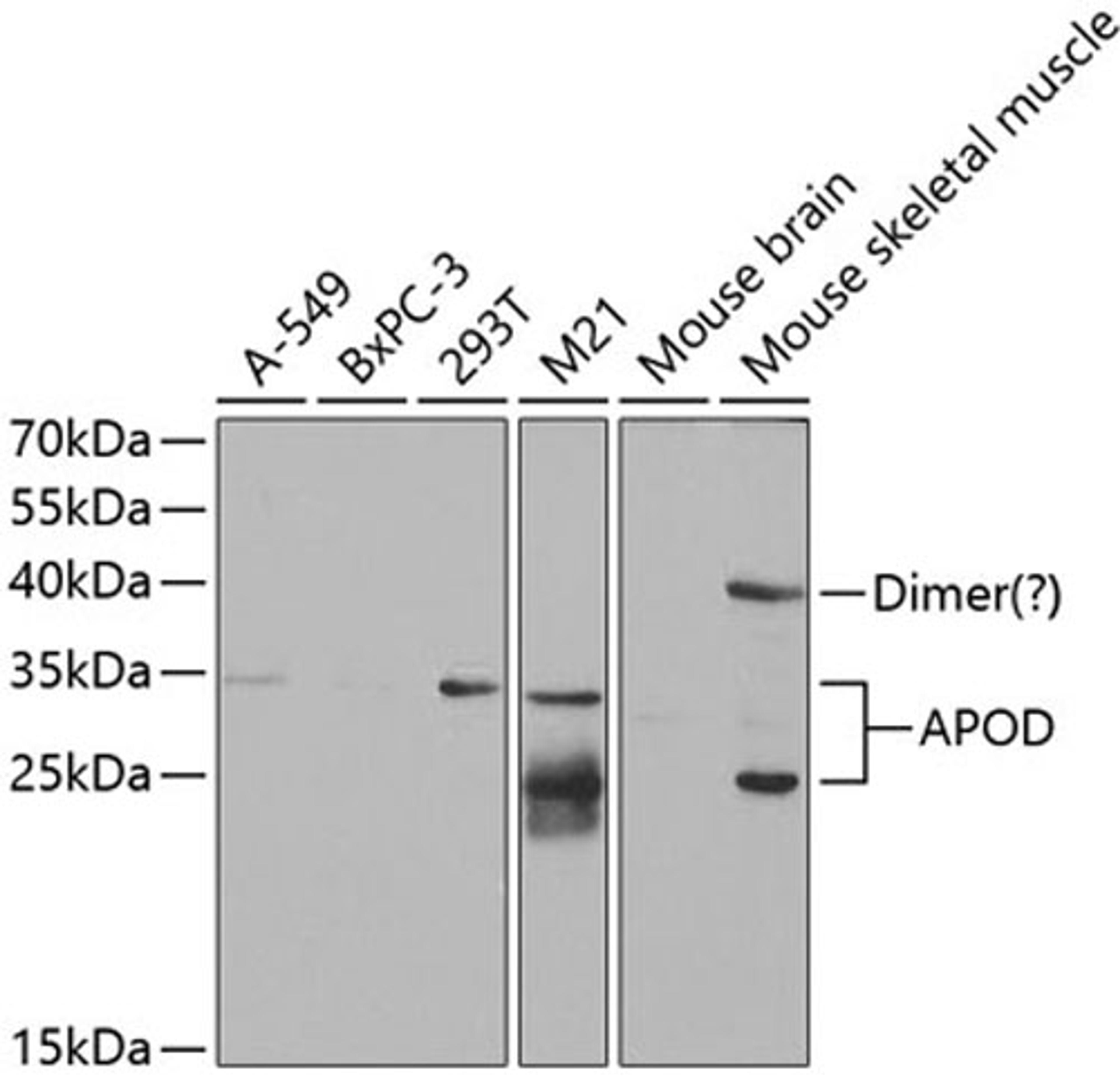 Western blot - APOD antibody (A5297)