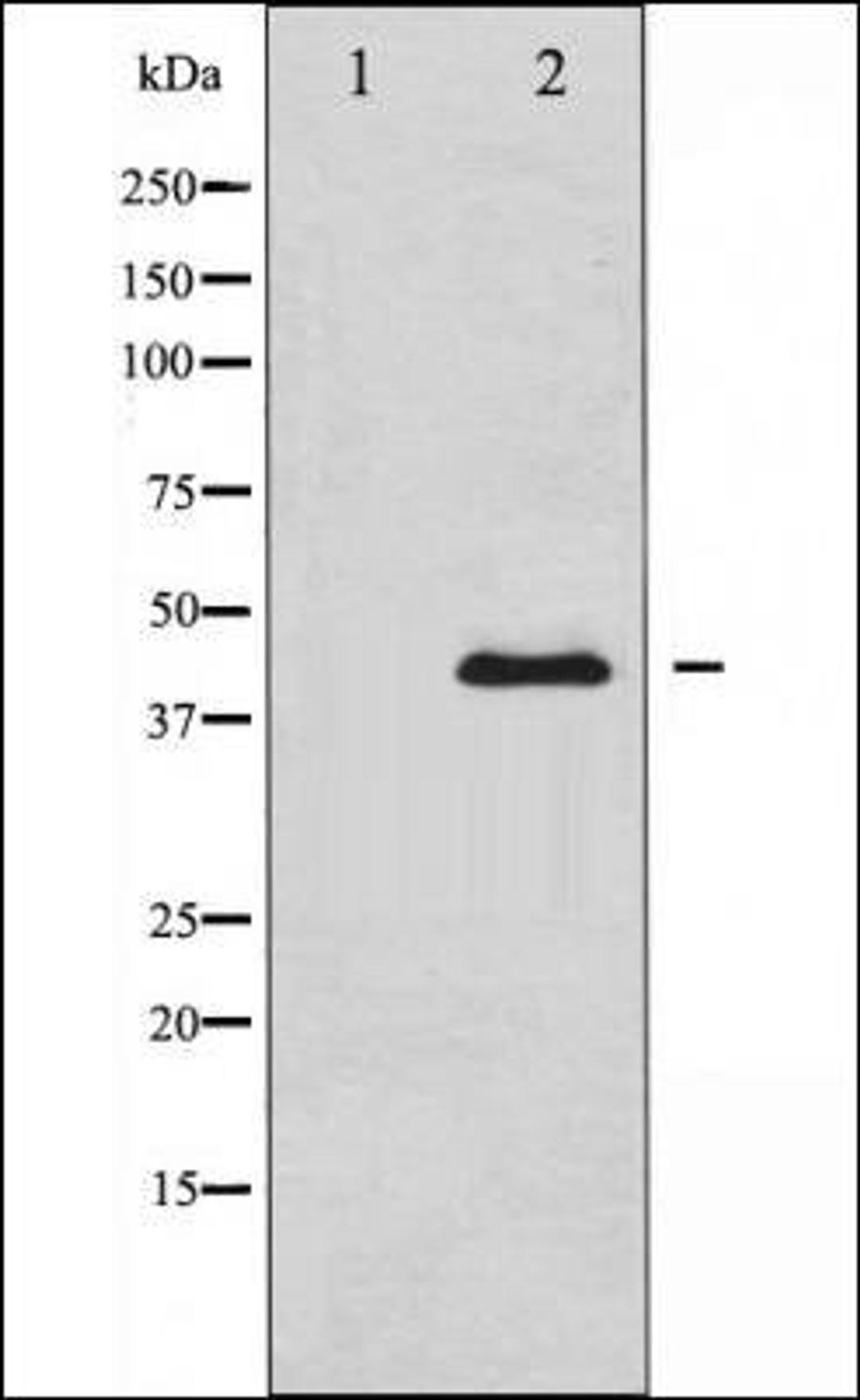 Western blot analysis of MCF-7 cells using PAI 1 antibody