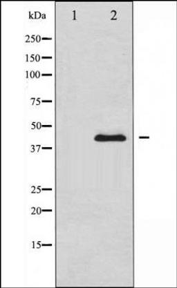 Western blot analysis of MCF-7 cells using PAI 1 antibody