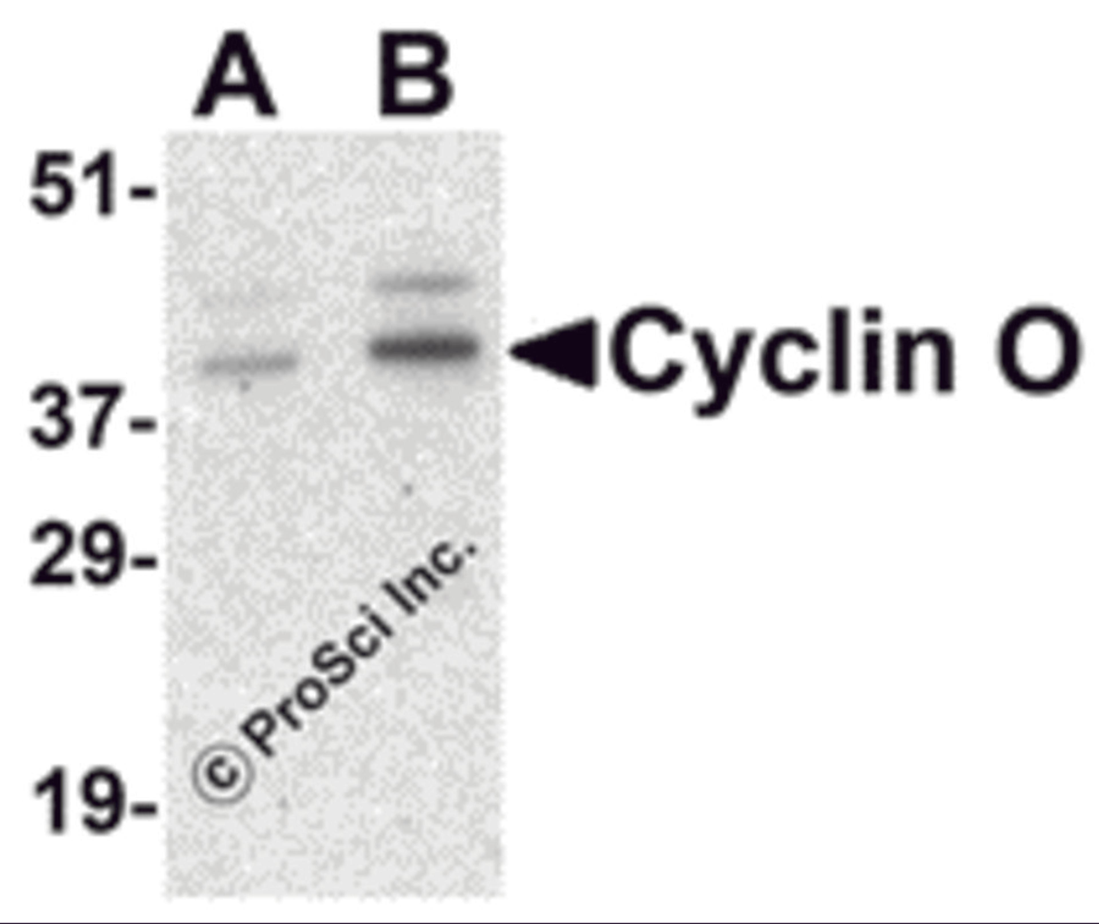 Western blot analysis of Cyclin O in human bladder tissue lysate with Cyclin O antibody at (A) 1 and (B) 2 &#956;g/mL.