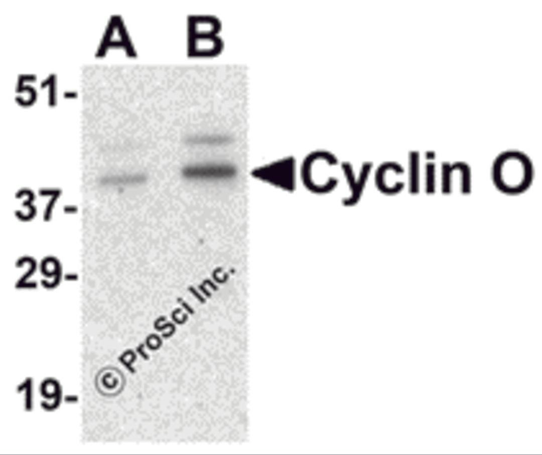 Western blot analysis of Cyclin O in human bladder tissue lysate with Cyclin O antibody at (A) 1 and (B) 2 μg/mL.