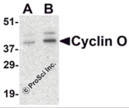 Western blot analysis of Cyclin O in human bladder tissue lysate with Cyclin O antibody at (A) 1 and (B) 2 μg/mL.