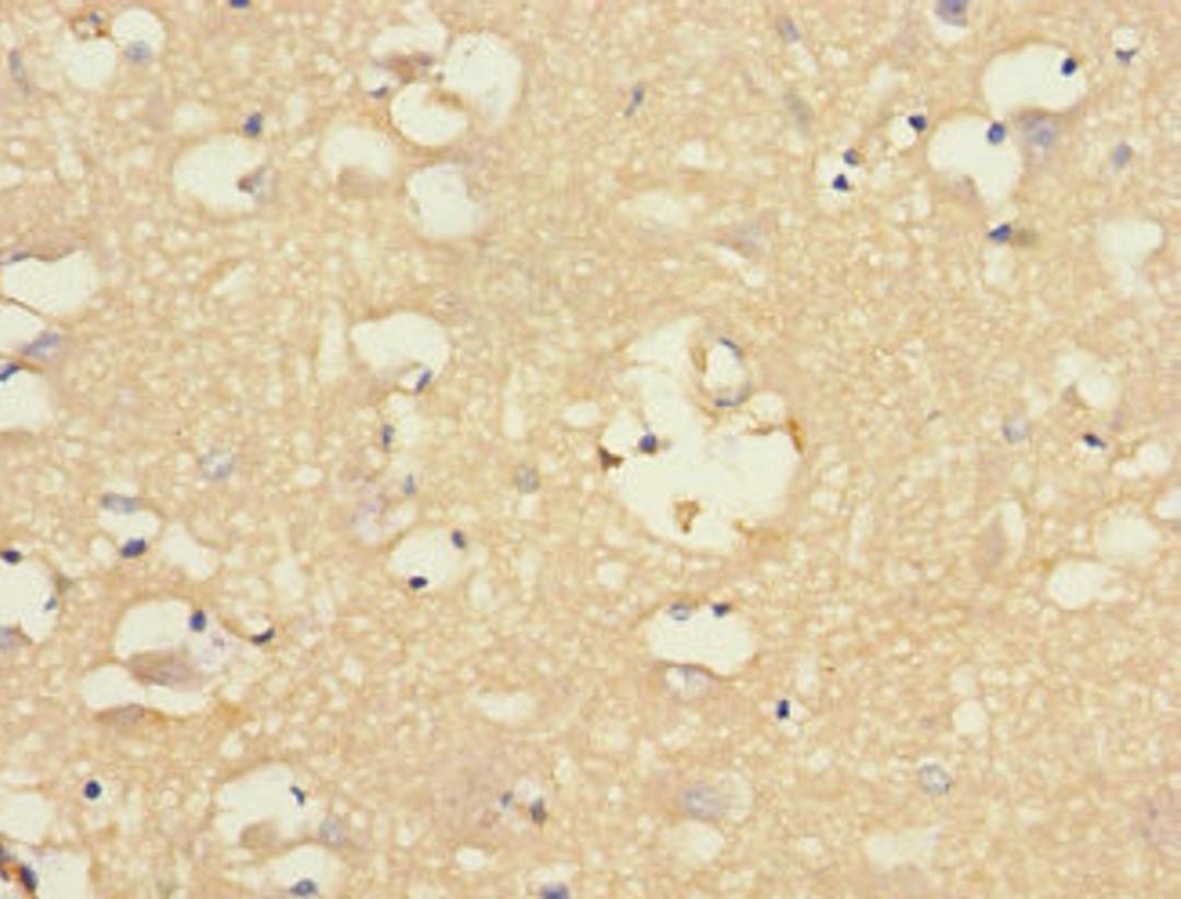 Immunohistochemistry of paraffin-embedded human brain tissue using CSB-PA887022ESR1HU at dilution of 1:100