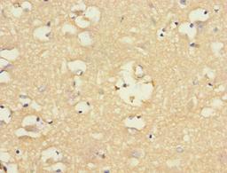 Immunohistochemistry of paraffin-embedded human brain tissue using CSB-PA887022ESR1HU at dilution of 1:100