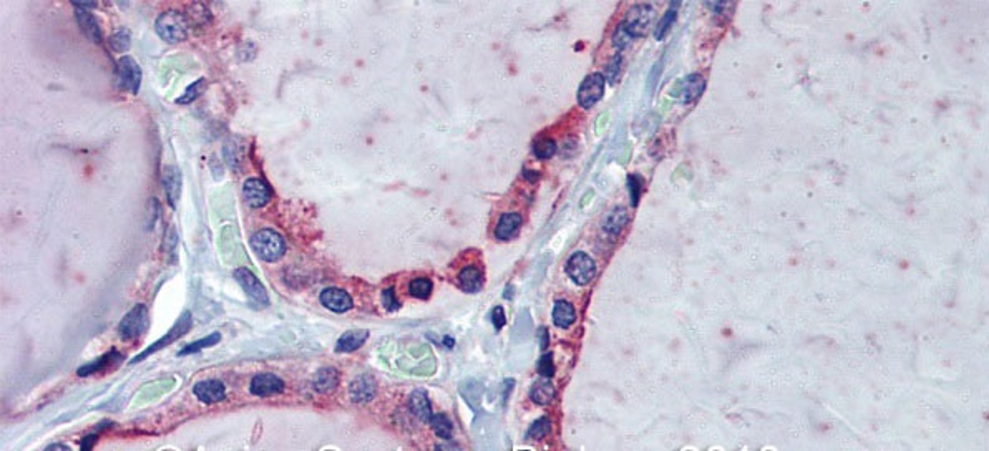 Antibody used in IHC on Human Thyroid at 5.0 ug/ml.