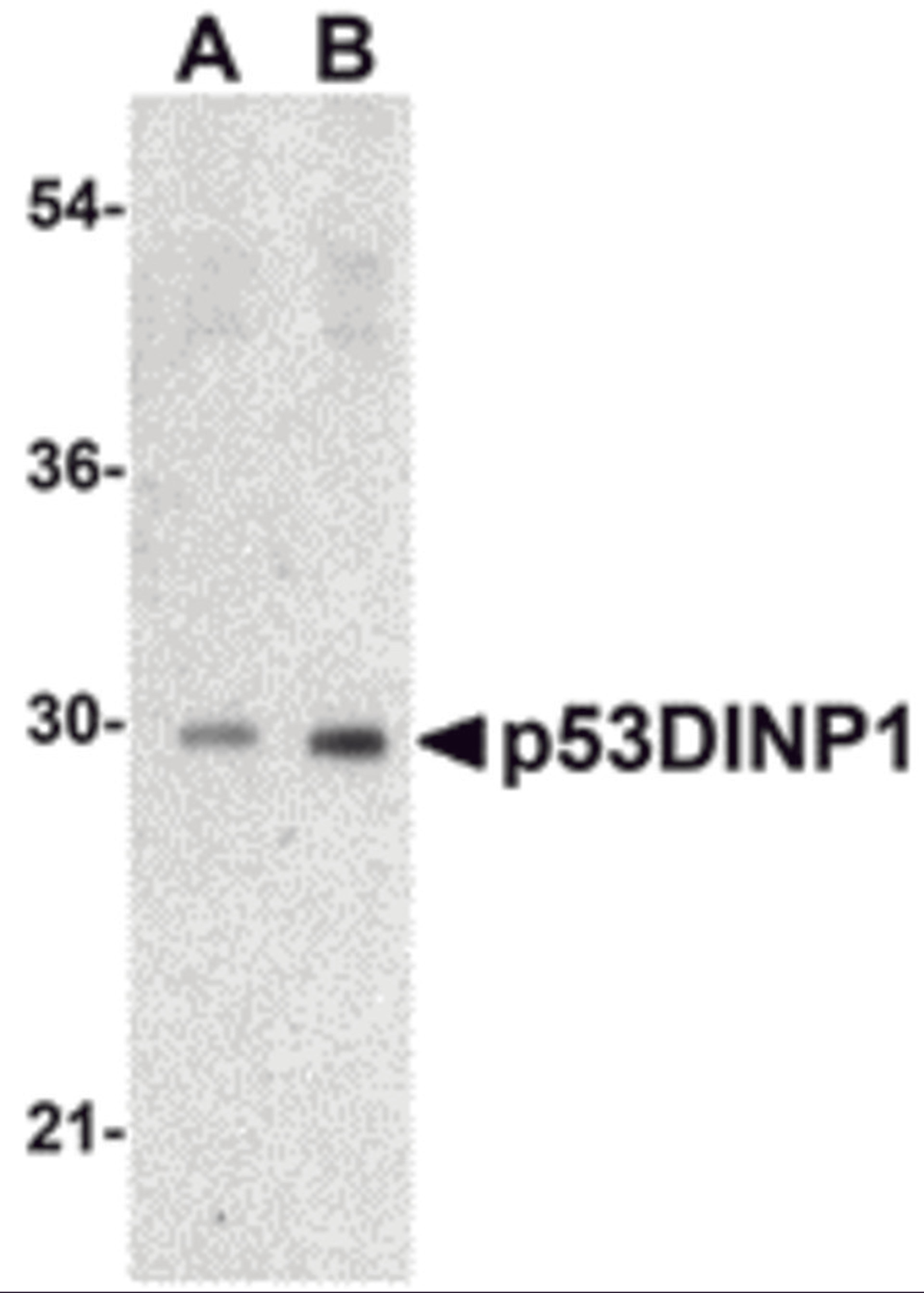 Western blot analysis of p53DINP1 expression in human lung tissue lysate with p53DINP1 antibody at (A) 0.5 and (B) 1 &#956;g/mL. 