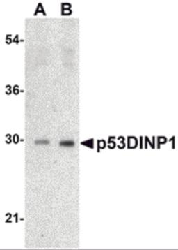 Western blot analysis of p53DINP1 expression in human lung tissue lysate with p53DINP1 antibody at (A) 0.5 and (B) 1 μg/mL.