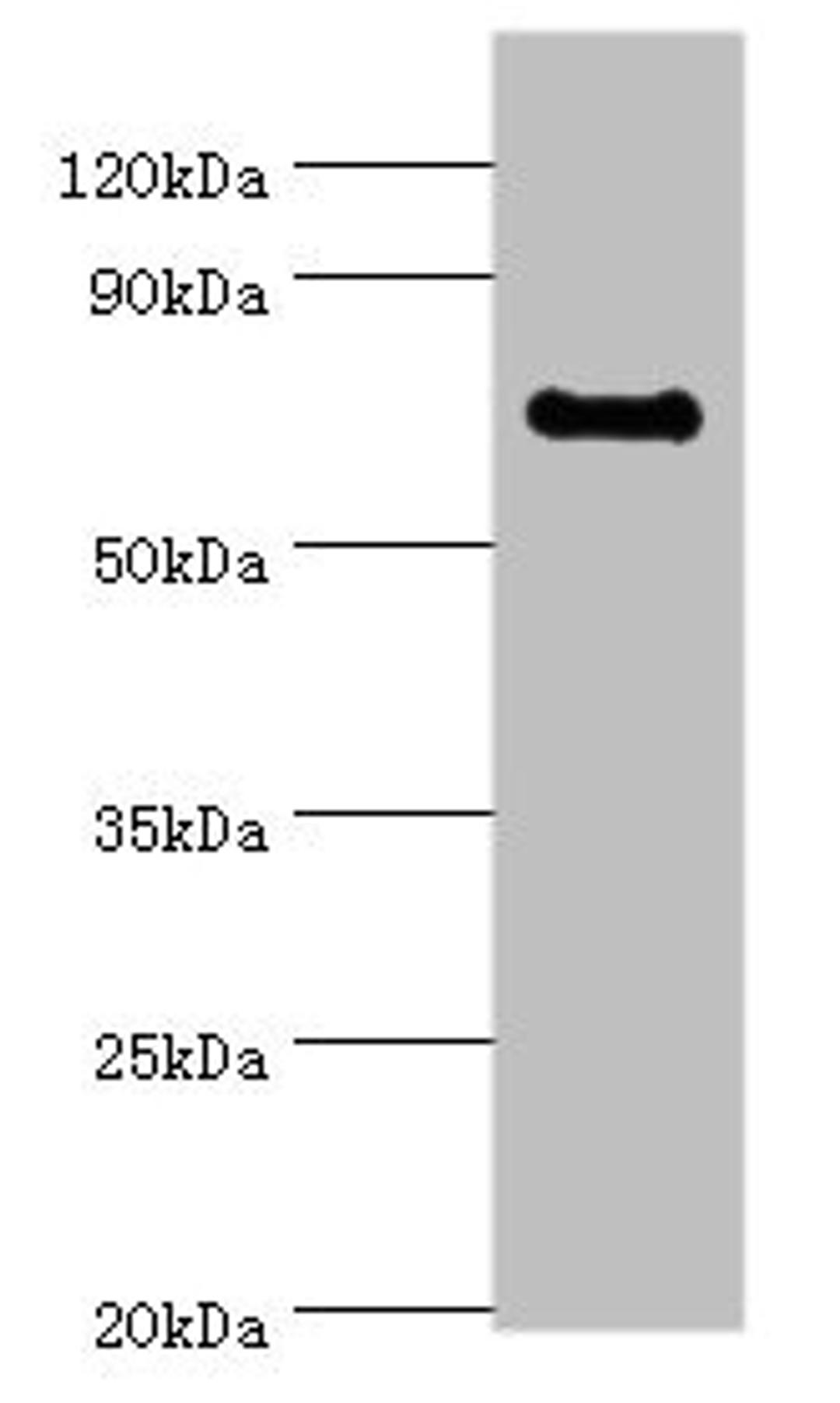 Western blot. All lanes: TAF5L antibody at 10ug/ml + Jurkat whole cell lysate. Secondary. Goat polyclonal to rabbit IgG at 1/10000 dilution. Predicted band size: 67, 37 kDa. Observed band size: 67 kDa. 