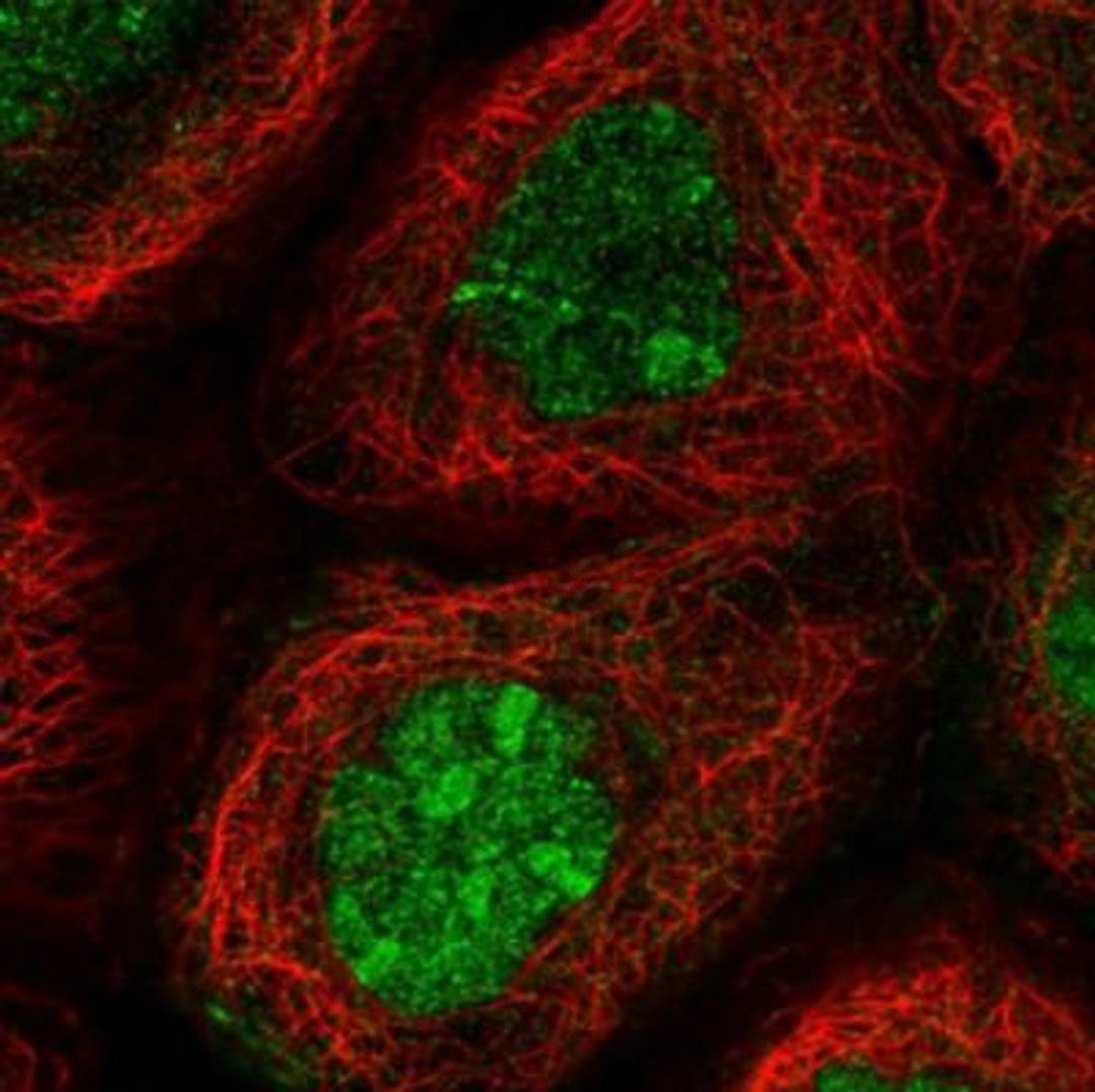 Immunocytochemistry/Immunofluorescence: ATF6 beta Antibody [NBP1-91687] - Staining of human cell line.